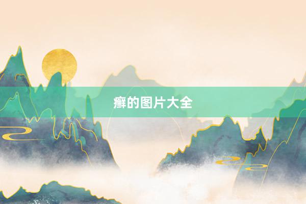 癣的图片大全